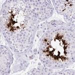 PRM2 Antibody in Immunohistochemistry (IHC)