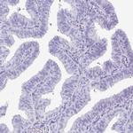 PRM2 Antibody in Immunohistochemistry (IHC)