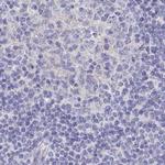 CHMP5 Antibody in Immunohistochemistry (IHC)