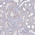 CHMP5 Antibody in Immunohistochemistry (IHC)