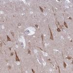 CAMLG Antibody in Immunohistochemistry (Paraffin) (IHC (P))