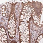 GPSN2 Antibody in Immunohistochemistry (Paraffin) (IHC (P))