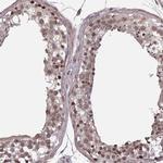 IPO5 Antibody in Immunohistochemistry (IHC)