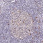 DERL2 Antibody in Immunohistochemistry (Paraffin) (IHC (P))