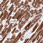 WDR38 Antibody in Immunohistochemistry (Paraffin) (IHC (P))