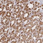 ZNF526 Antibody in Immunohistochemistry (Paraffin) (IHC (P))