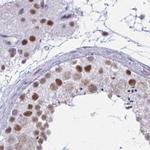 PPP1R10 Antibody in Immunohistochemistry (IHC)