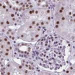 PPP1R10 Antibody in Immunohistochemistry (IHC)