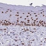 PPP1R10 Antibody in Immunohistochemistry (IHC)