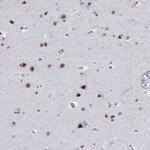 PPP1R10 Antibody in Immunohistochemistry (IHC)