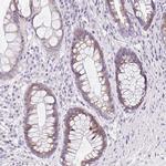 DTX4 Antibody in Immunohistochemistry (IHC)