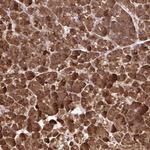 PAIP2 Antibody in Immunohistochemistry (Paraffin) (IHC (P))