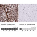 SAM68 Antibody in Immunohistochemistry (IHC)