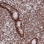 SAM68 Antibody in Immunohistochemistry (IHC)