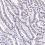 CPTP Antibody in Immunohistochemistry (Paraffin) (IHC (P))