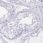 CPTP Antibody in Immunohistochemistry (Paraffin) (IHC (P))