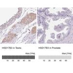 HSD17B3 Antibody