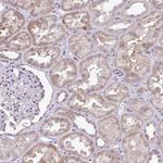 PYCR2 Antibody in Immunohistochemistry (Paraffin) (IHC (P))