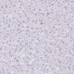 PYCR2 Antibody in Immunohistochemistry (Paraffin) (IHC (P))