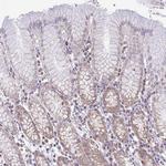 PYCR2 Antibody in Immunohistochemistry (Paraffin) (IHC (P))