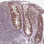 PYCR2 Antibody in Immunohistochemistry (IHC)