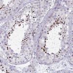 OXLD1 Antibody in Immunohistochemistry (Paraffin) (IHC (P))