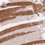 TNNT3 Antibody in Immunohistochemistry (Paraffin) (IHC (P))