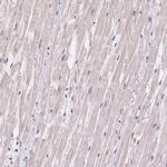 TNNT3 Antibody in Immunohistochemistry (IHC)