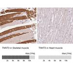 TNNT3 Antibody