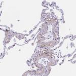 Elastin Antibody in Immunohistochemistry (Paraffin) (IHC (P))