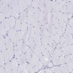 Elastin Antibody in Immunohistochemistry (Paraffin) (IHC (P))