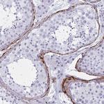 Elastin Antibody in Immunohistochemistry (Paraffin) (IHC (P))