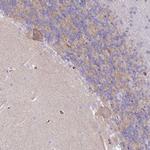 Ankyrin 1 Antibody in Immunohistochemistry (Paraffin) (IHC (P))