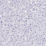 Ankyrin 1 Antibody in Immunohistochemistry (Paraffin) (IHC (P))