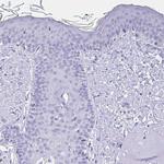 Ankyrin 1 Antibody in Immunohistochemistry (Paraffin) (IHC (P))