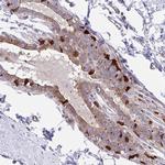 EFHD1 Antibody in Immunohistochemistry (IHC)