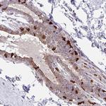 EFHD1 Antibody in Immunohistochemistry (IHC)