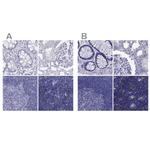 PSMB11 Antibody in Immunohistochemistry (IHC)