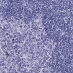 PSMB11 Antibody in Immunohistochemistry (IHC)