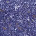 PSMB11 Antibody in Immunohistochemistry (IHC)