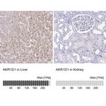 AKR1D1 Antibody in Immunohistochemistry (IHC)