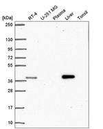 AKR1D1 Antibody in Western Blot (WB)