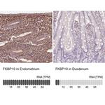 FKBP10 Antibody