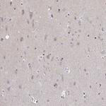 SLC7A10 Antibody in Immunohistochemistry (Paraffin) (IHC (P))