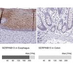 SERPINB13 Antibody in Immunohistochemistry (IHC)