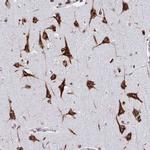 RFK Antibody in Immunohistochemistry (Paraffin) (IHC (P))