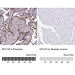 MYH10 Antibody in Immunohistochemistry (IHC)