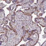 MYH10 Antibody in Immunohistochemistry (IHC)