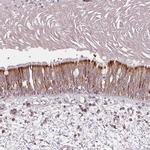 DGUOK Antibody in Immunohistochemistry (Paraffin) (IHC (P))