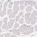 DGUOK Antibody in Immunohistochemistry (Paraffin) (IHC (P))